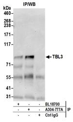 TBL3 Antibody in Immunoprecipitation (IP)