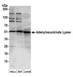 Adenylosuccinate Lyase/ADSL Polyclonal Antibody