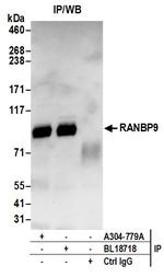 RANBP9 Antibody in Immunoprecipitation (IP)