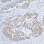 CBS Polyclonal Antibody