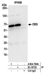 CBS Antibody in Immunoprecipitation (IP)
