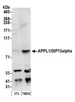 APPL1/DIP13alpha Antibody in Western Blot (WB)