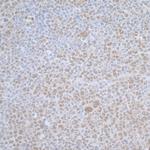 TCEB1 Antibody in Immunohistochemistry (Paraffin) (IHC (P))