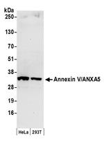 Annexin V/ANXA5 Polyclonal Antibody