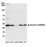Annexin V/ANXA5 Polyclonal Antibody