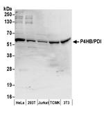P4HB/PDI Polyclonal Antibody