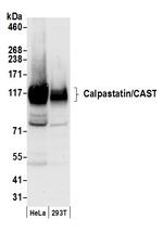 Calpastatin/CAST Polyclonal Antibody