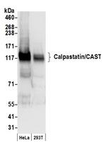 Calpastatin/CAST Polyclonal Antibody