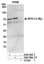 MYCL1/L-Myc Polyclonal Antibody