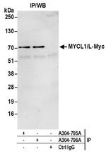 MYCL1/L-Myc Polyclonal Antibody