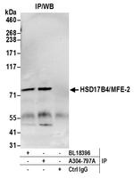 HSD17B4/MFE-2/17-beta-HSD4 Polyclonal Antibody