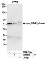 Aspartyl-tRNA Synthetase/DARS Antibody in Immunoprecipitation (IP)