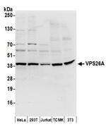VPS26A Polyclonal Antibody