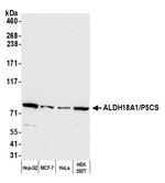 ALDH18A1/P5CS Polyclonal Antibody