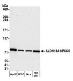 ALDH18A1/P5CS Polyclonal Antibody