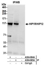 HIP1R/HIP12 Antibody in Immunoprecipitation (IP)