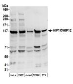 HIP1R/HIP12 Polyclonal Antibody
