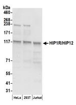 HIP1R/HIP12 Polyclonal Antibody