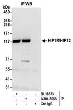 HIP1R/HIP12 Antibody in Immunoprecipitation (IP)