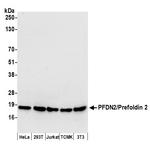 PFDN2/Prefoldin 2 Polyclonal Antibody