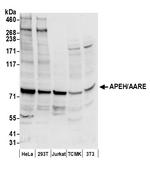 APEH/AARE Polyclonal Antibody