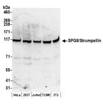 SPG8/Strumpellin Polyclonal Antibody