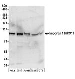 Importin 11/IPO11 Polyclonal Antibody