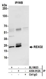 REXO2 Antibody in Immunoprecipitation (IP)
