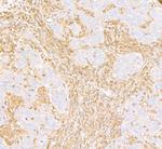 ARHGDIB/D4-GDI/RhoGDI2 Polyclonal Antibody