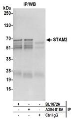 STAM2 Antibody in Immunoprecipitation (IP)