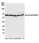 SF3A2/SAP62 Polyclonal Antibody