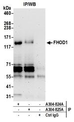 FHOD1 Antibody in Immunoprecipitation (IP)