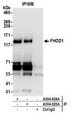 FHOD1 Antibody in Immunoprecipitation (IP)