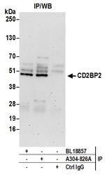 CD2BP2 Polyclonal Antibody