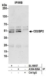 CD2BP2 Antibody in Immunoprecipitation (IP)