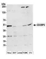 CD2BP2 Polyclonal Antibody