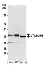 VTA1/LIP5 Polyclonal Antibody