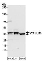 VTA1/LIP5 Polyclonal Antibody