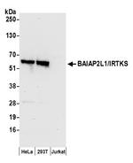 BAIAP2L1/IRTKS Polyclonal Antibody