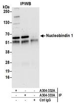 Nucleobindin 1/NUCB1 Polyclonal Antibody
