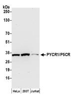 PYCR1/P5CR Polyclonal Antibody