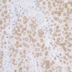 LAP2 alpha beta gamma/TMPO Antibody in Immunohistochemistry (Paraffin) (IHC (P))