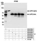 LAP2 alpha beta gamma/TMPO Antibody in Immunoprecipitation (IP)