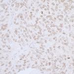 LAP2 alpha/TMPO Antibody in Immunohistochemistry (Paraffin) (IHC (P))
