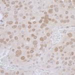LAP2 alpha/TMPO Antibody in Immunohistochemistry (Paraffin) (IHC (P))