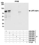 LAP2 alpha/TMPO Antibody in Immunoprecipitation (IP)
