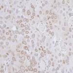 LAP2 beta/TMPO Polyclonal Antibody