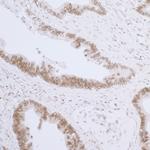 LAP2 beta/TMPO Antibody in Immunohistochemistry (Paraffin) (IHC (P))