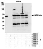 LAP2 beta/TMPO Antibody in Immunoprecipitation (IP)