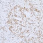 LAP2 beta/TMPO Polyclonal Antibody